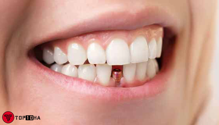 دندانپزشکی نسترن