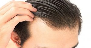 بهترین کلینیک کاشت مو در شیراز + [۱۰ کلینیک برتر کاشت مو]