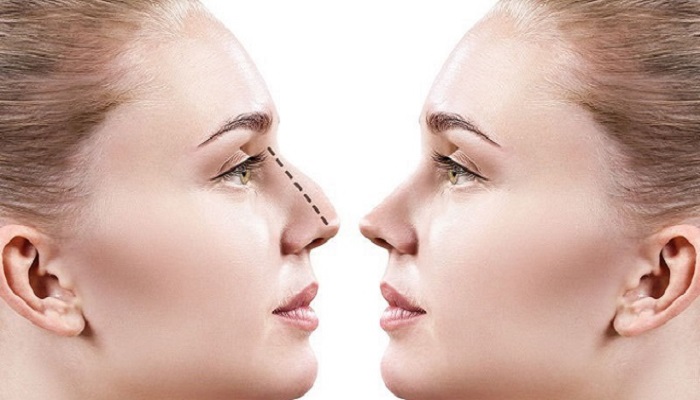 بهترین جراح بینی اصفهان برای بینی‌های گوشتی