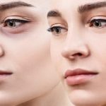 بهترین جراح بینی در شیراز + ۱۰تا از بهترین‌های این حوزه