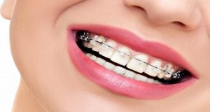 بهترین دکتر ارتودنسی در تهران + [شناخت ۱۰ پزشک برتر ارتودنسی تهران]