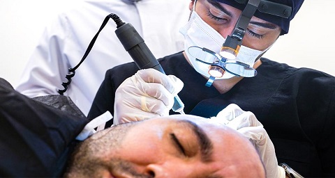 بهترین کلینیک کاشت مو در تبریز + [۱۰ کلینیک کاشت موی برتر]