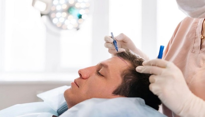 آشنایی با بهترین کلینیک کاشت مو ارومیه