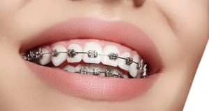 بهترین دکتر ارتودنسی در اصفهان + [۱۰ پزشک ارتودنسی برتر اصفهان]